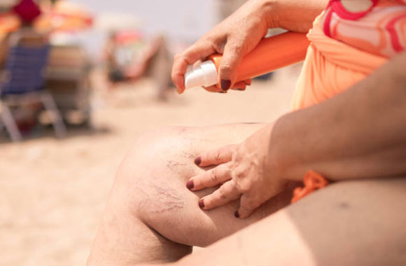 Yazda Varis Rehberi: Isı, Hidrasyon, Kompresyon